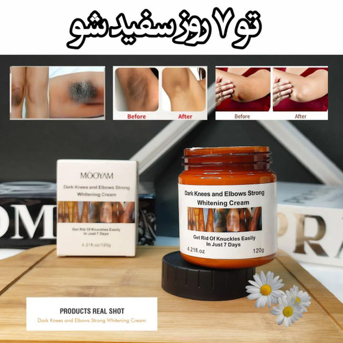 قیمت و خرید عمده کرم روشن کننده زانو و آرنج مویام - کد عمده 41